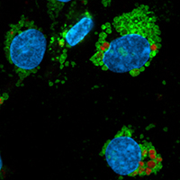 Lysosomal labelling with mouse anti-human LAMP-1 antibody (green) shows that the autofluorescent material (red) is located within LAMP-1 positive vesicles (arrow heads)